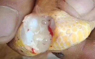 雞拉綠色糞便的原因，感染傷寒、患上禽霍亂等因素均會導(dǎo)致