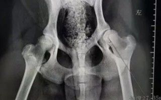 犬髖關(guān)節(jié)發(fā)育不良的簡介，是一種后天發(fā)育畸形、由多種病因引發(fā)的疾病
