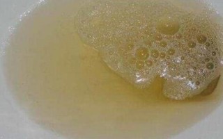 為什么用尿做肥料不是好的選擇，有危險(xiǎn)性且其代替品多
