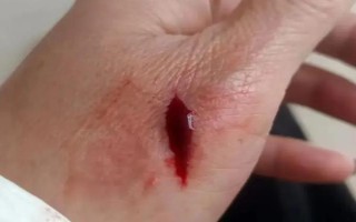 狂犬病的癥狀，狗狗會(huì)出現(xiàn)精神沉郁、唾液增多等癥狀